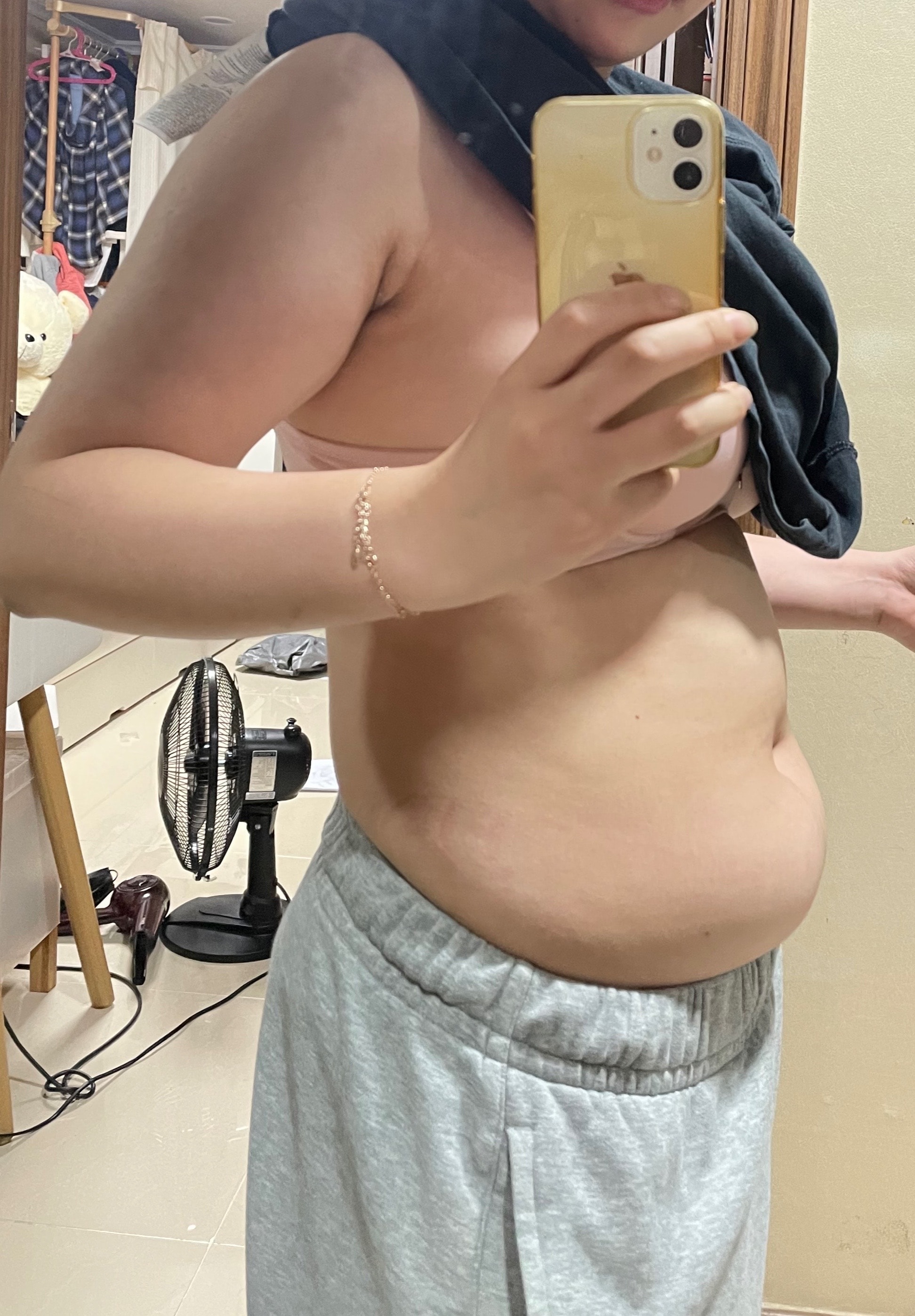 허파고리 약 1면 팔뚝 지흡 약 6개월차 후기