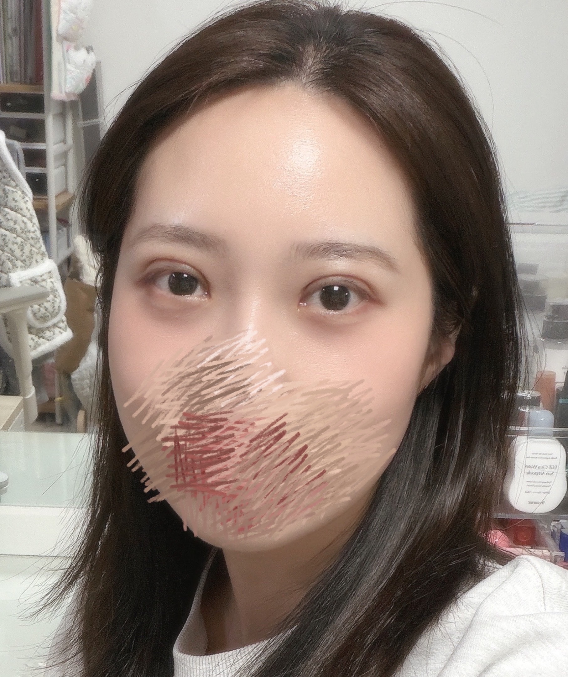 눈 붓기때문에 스트레스가 커 진지하게 봐줘 ㅜㅜ