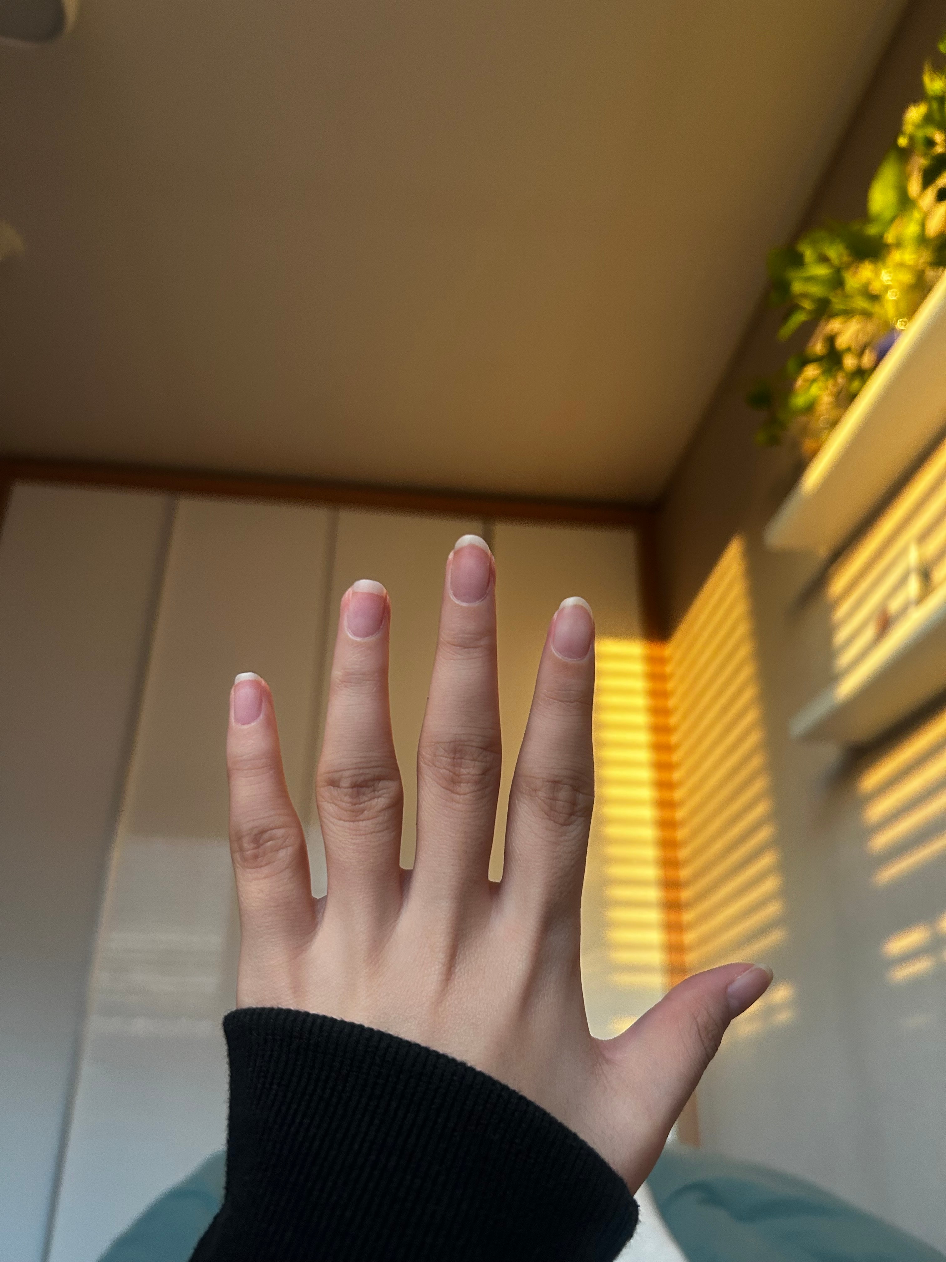 손가락 마디 돌아오는 방법 없을까…