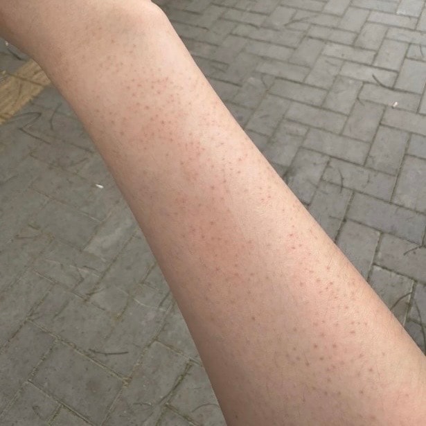 내 닭살피부 진짜 용됐슴..