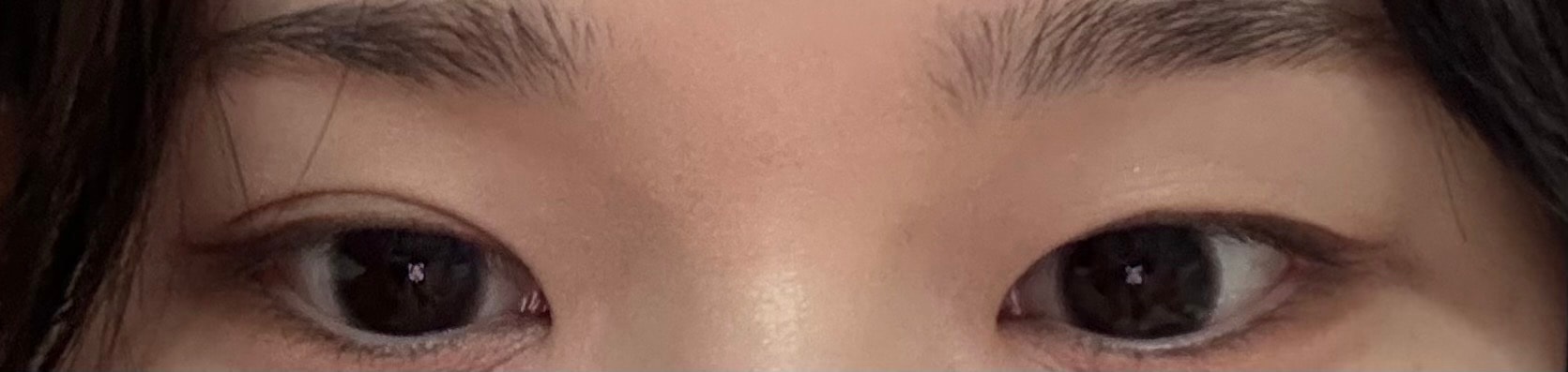 개눈이지 ㅠㅠㅠㅠ??