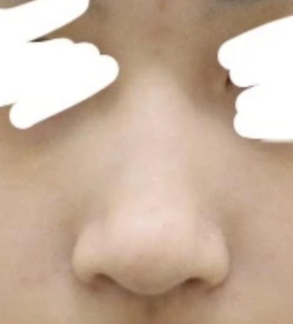 복코교정(연골묶기)만 하고싶은 언니들